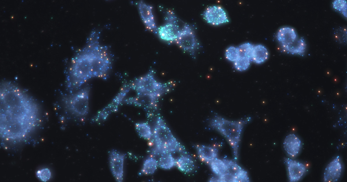 Nanoparticules métalliques fixées à des cellules cancéreuses