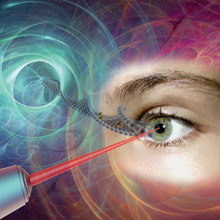 Un grand pas vers la thérapie génique oculaire non virale grâce au laser et à la nanotechnologie