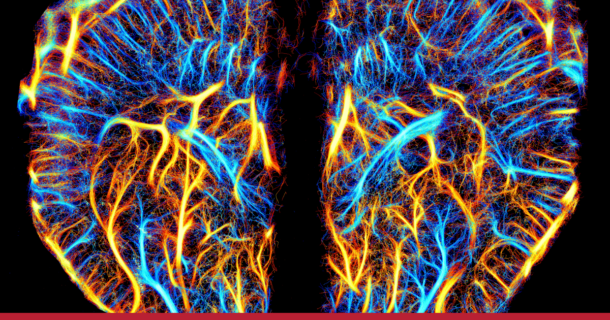 Cerveau d’une souris cartographié par microscopie de localisation ultrasonore Cerveau d’une souris cartographié par microscopie de localisation ultrasonore