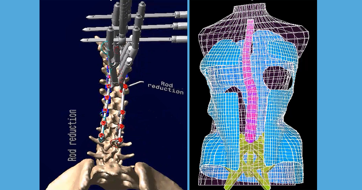 Modélisation de corsets