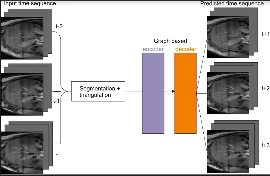 Temporal graph neural network Temporal graph neural network using segmentation and triangulation of real time CT sequences to predict liver motion.