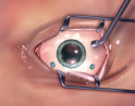 2-oeil.png