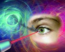 Le scalpel de lumière de Polytechnique Montréal. Des nanoparticules d’or, qui agissent comme des « nanolentilles », concentrent l’énergie produite par l’impulsion extrêmement brève d’un laser femtoseconde pour créer une incision nanométrique à la surface des cellules de la rétine de l’œil. Cette technologie, qui préserve l’intégrité des cellules, pourra permettre d’injecter efficacement des médicaments ou des gènes dans des zones spécifiques de l’œil, offrant un nouvel espoir aux personnes atteintes de glau