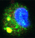 La chaîne de chitosane, lorsqu’elle est de la bonne longueur, est expulsée du phagosome (les boules jaunes); le macrophage réagit comme s’il faisait face à une bactérie et produit des molécules anti-inflammatoires.