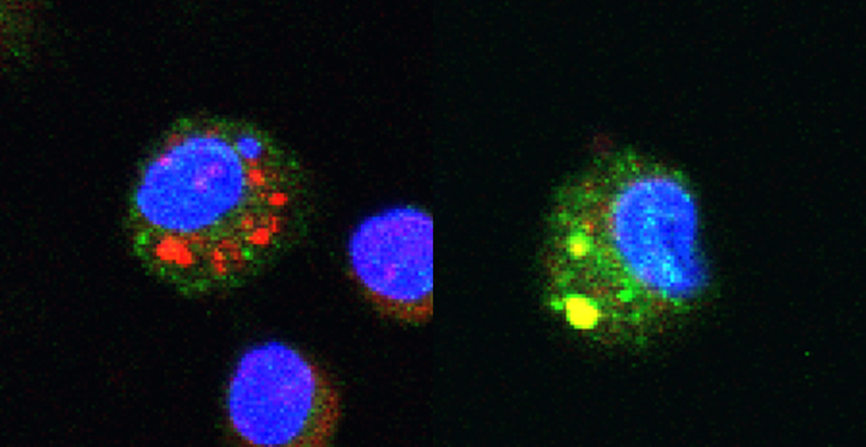 Left image: Chitosan, perceived as a foreign body, is absorbed and retained in the phagosomes of a macrophage (small red patches). Right image: the chitosan chain, when it is of the right length, becomes expelled from the phagosome (yellow patches); the macrophage reacts as though being faced with a bacterium and produces anti-inflammatory molecules Left image: Chitosan, perceived as a foreign body, is absorbed and retained in the phagosomes of a macrophage (small red patches). Right image: the chitosan chain, when it is of the right length, becomes expelled from the phagosome (yellow patches); the macrophage reacts as though being faced with a bacterium and produces anti-inflammatory molecules